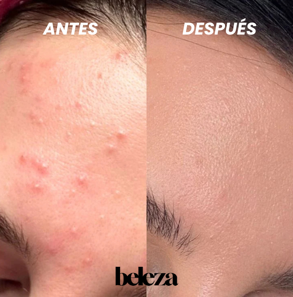 TOALLA EXFOLIANTE JAPONESA | 2x1