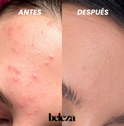 TOALLA EXFOLIANTE JAPONESA | 2x1